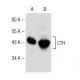 western blotting image from recommended CTH (F-1) monoclonal antibody replacement. Image 149503