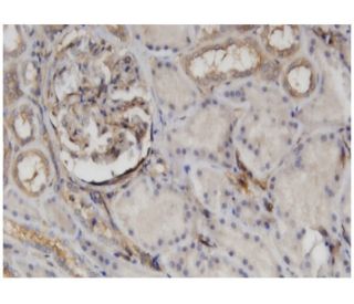 CTHRC1 Antibody (1G12) - Immunohistochemistry - Image 346153 