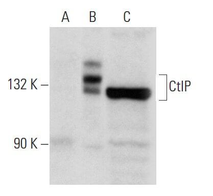 CtIP Antibody (E-2) | SCBT - Santa Cruz Biotechnology