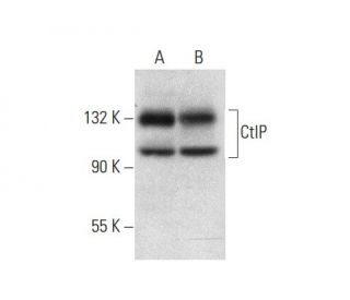 western blotting image from recommended CtIP (D-4) monoclonal antibody replacement. Image 296902