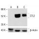 CTL2 Antibody (F7) - Western Blotting - Image 412773