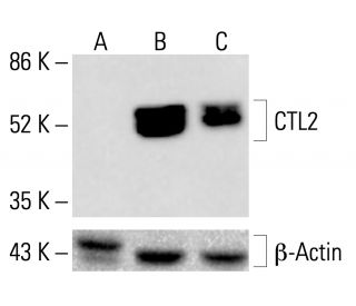 CTL2 Antibody (F7) - Western Blotting - Image 412773