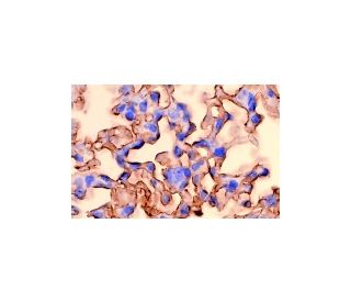 CTLA-4 Antibody (1B8) - Immunohistochemistry - Image 4789
