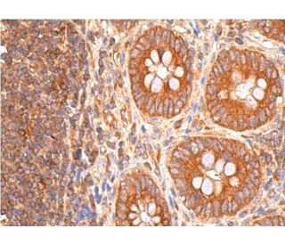 western blotting image from recommended CTLA-4 (F-8) monoclonal antibody replacement. Image 384628