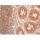 western blotting image from recommended CTLA-4 (F-8) monoclonal antibody replacement. Image 384628