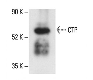 CTP Antibody (C-12) - Western Blotting - Image 404827 