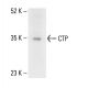 CTP Antibody (C-12) - Western Blotting - Image 404828