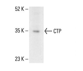 CTP Antibody (C-12) - Western Blotting - Image 404828Each CRISPR/Cas9 Knockout (KO) Plasmid product consists of a pool of 3 plasmids designed to ensure identification and cleavage of a specific gene for maximum knockout efficiency. Each plasmid encodes a unique 20 nt sequence derived from the GeCKO (v2) library.