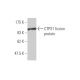 western blotting image from recommended CTPS1 (2G7-1D10) monoclonal antibody replacement. Image 348464