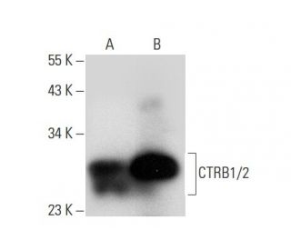 CTRB1/2 Antibody (B-3) - Western Blotting - Image 308142 