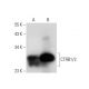 CTRB1/2 Antibody (B-3) - Western Blotting - Image 308142 