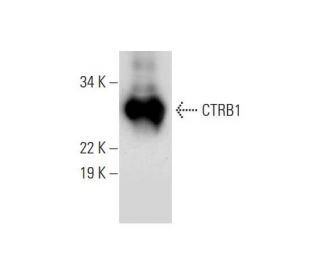 CTRB1/2 Antibody (D-5) - Western Blotting - Image 295761 