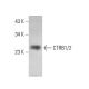 CTRB1/2 Antibody (D-5) - Western Blotting - Image 376387