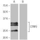 CTRP2 Antibody (10B8) - Western Blotting - Image 64901