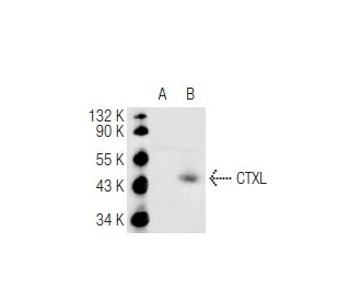 CTXL Antibody (ICO-44) - Western Blotting - Image 67158