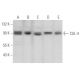 This polyclonal antibody has been discontinued. See our recommended <a href="cul-4-antibody-h-11">CUL-4 (H-11)</a> monoclonal antibody (sample data shown). western blotting image from recommended CUL-4 (H-11) monoclonal antibody replacement. Image 356696