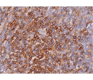 CXCR-3 Antibody (H-1) | SCBT - Santa Cruz Biotechnology