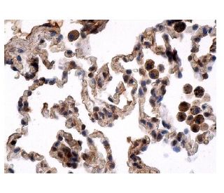 Anti Cxcr 4 Antibody 4g10 Scbt Santa Cruz Biotechnology