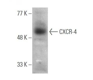 CXCR-4 Antibody (4G10) - Western Blotting - Image 370785SAM Transcription Activation: SAM system utilizing dCas9-VP64, MS2-P65-HSF1, and sgRNA for precise gene transcription activation.
