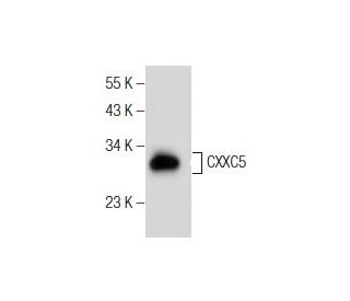 CXXC5 Antibody (H-6) - Western Blotting - Image 155277Each CRISPR/Cas9 Knockout (KO) Plasmid product consists of a pool of 3 plasmids designed to ensure identification and cleavage of a specific gene for maximum knockout efficiency. Each plasmid encodes a unique 20 nt sequence derived from the GeCKO (v2) library. 