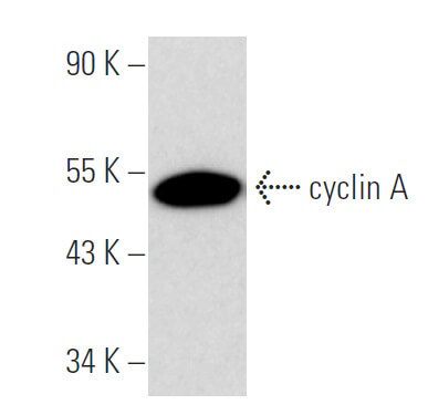 ronです☆。.:＊・゜ cyclin-a-antibody-b-8-western-