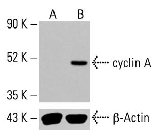 のん CDC20-Mediated hnRNPU Ubiquitination Regulates Chromatin