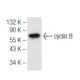 western blotting image from recommended cyclin B (D-1) monoclonal antibody replacement. Image 68226