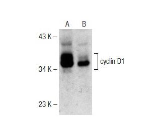 cyclin D1 Antibody 72 13G SCBT Santa Cruz Biotechnology