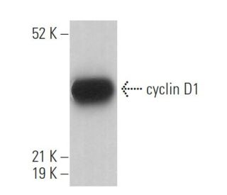 cyclin D1 Antibody 72 13G SCBT Santa Cruz Biotechnology