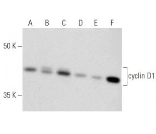 western blotting image from recommended cyclin D1 (A-12) monoclonal antibody replacement. Image 354344