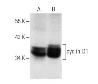 cyclin D1 Antibody (DCS-6) - Western Blotting - Image 536 