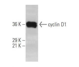 cyclin D1 Antibody (HD11) - Western Blotting - Image 537