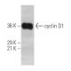cyclin D1 Antibody (HD11) - Western Blotting - Image 537