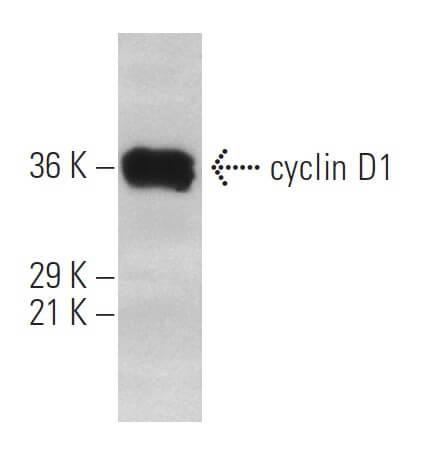 cyclin D1 Antibody HD11 SCBT Santa Cruz Biotechnology