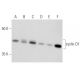 western blotting image from recommended cyclin D1 (A-12) monoclonal antibody replacement. Image 354344