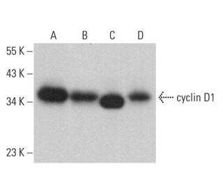 cyclin D1 Antibody (72-13G) - Western Blotting - Image 379654