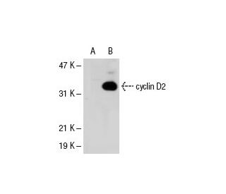 cyclin D2 Antibody (34B1-3) - Western Blotting - Image 40601