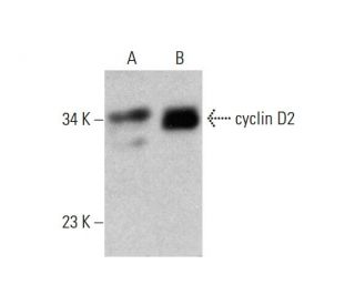 western blotting image from recommended cyclin D2 (B-6) monoclonal antibody replacement. Image 384488