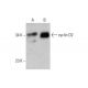 western blotting image from recommended cyclin D2 (B-6) monoclonal antibody replacement. Image 384488