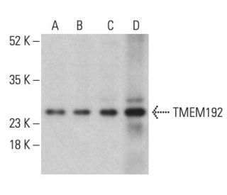 TMEM192 Antibody (F-12) - Western Blotting - Image 401236The Double Nickase Plasmid features a U6 promoter for sgRNA expression, a 20 nt targeting sequence, and a gRNA scaffold to guide Cas9n. It includes a CBh promoter for Cas9n (D10A) and puromycin resistance, GFP for transfection verification, and nuclear localization signals (NLS). The 2A peptide allows co-expression of Cas9n and Puro from a single promoter, enabling precise genome editing with reduced off-target effects. 