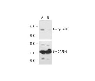 cyclin D3 siRNA (h): sc-35136. Western blot analysis of cyclin D3 expression in non-transfected control (A) and cyclin D3 