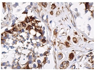 cyclin E Antibody (HE12) | SCBT - Santa Cruz Biotechnology