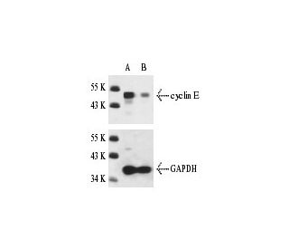 cyclin E siRNA (h): sc-29288. Western blot analysis of cyclin E expression in non-transfected control (A) and cyclin E siR 