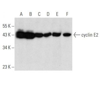 western blotting image from recommended cyclin E2 (A-9) monoclonal antibody replacement. Image 357302
