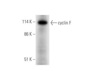 western blotting image from recommended cyclin F (B-6) monoclonal antibody replacement. Image 344561