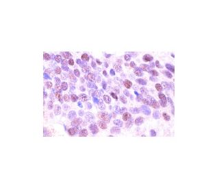 immunohistochemistry image from recommended cyclin G1 (F-5) monoclonal antibody replacement. Image 555