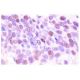 immunohistochemistry image from recommended cyclin G1 (F-5) monoclonal antibody replacement. Image 555