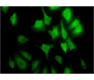 immunofluorescence image from recommended cyclin G2 (1F9-C11) monoclonal antibody replacement. Image 346112