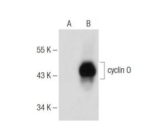 cyclin 0 (F-3): sc-374633. Western blot analysis of cyclin 0 expression in non-transfected: sc-117752 (A) and human cyclin