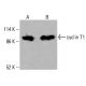 Anticorpo ciclina T1 (F-8): sc-515067. Análise por Western blot da expressão da ciclina T1 em lisados celulares completos de HeLa (A) e HCT-116 (B). Reagente de detecção utilizado: m-IgG Fc BP-HRP: sc-525409. cyclin T1 Antibody (F-8) - Western Blotting - Image 415868
